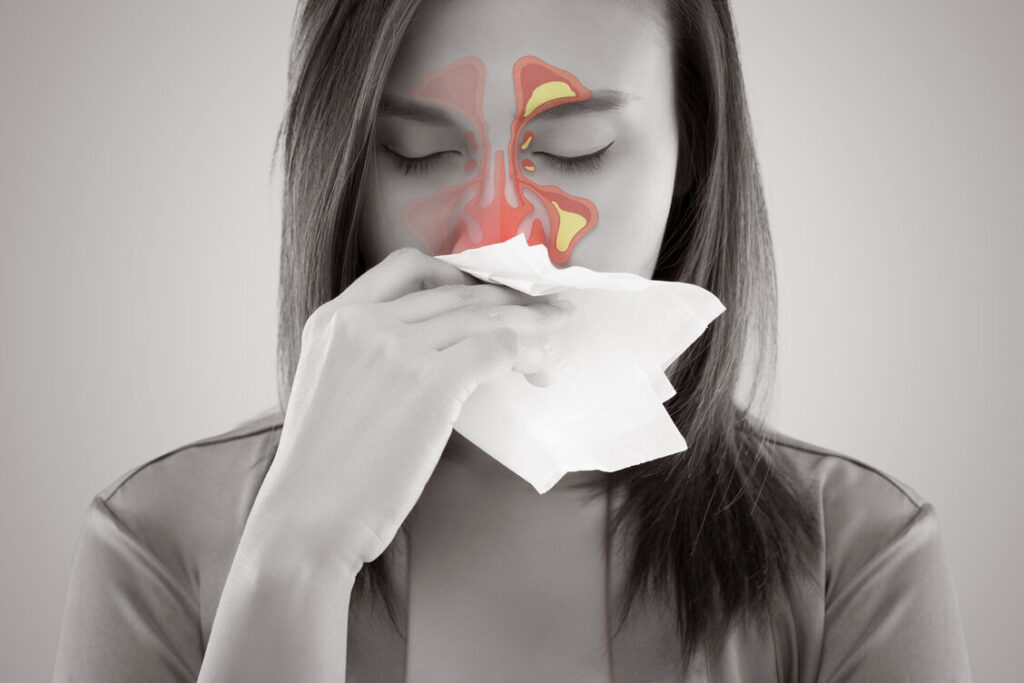 Allergie et sinusite: comment les distinguer et les traiter efficacement ?